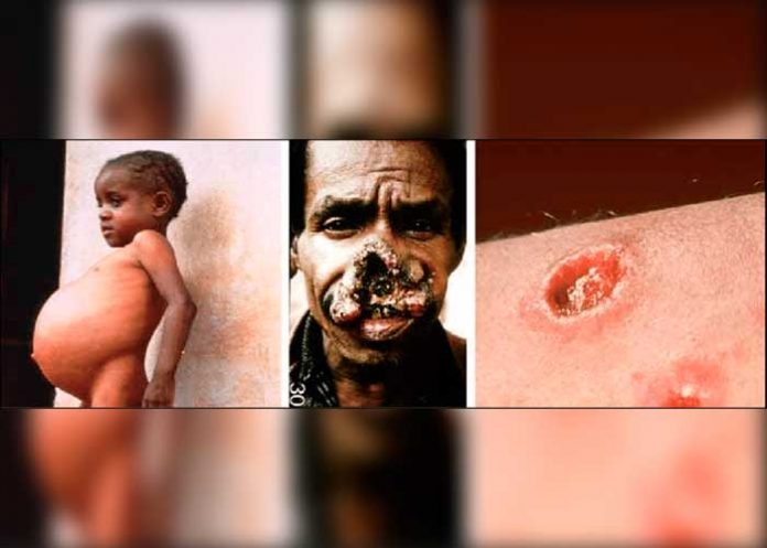 PORTADA_WpacKi3 enfermedad