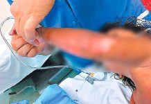 Muere niña hondureña que sufría quemaduras en un 80% tras caer en una olla hirviendo victima mortal