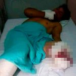 La Bestia mutila pierna a hondureño que se fue en caravana caravana migrante