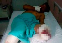 La Bestia mutila pierna a hondureño que se fue en caravana caravana migrante
