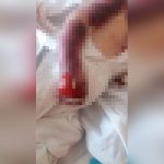 Bebé muere por quemaduras de tercer grado en una incubadora artesanal bolivia