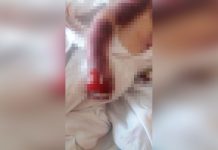 Bebé muere por quemaduras de tercer grado en una incubadora artesanal bolivia
