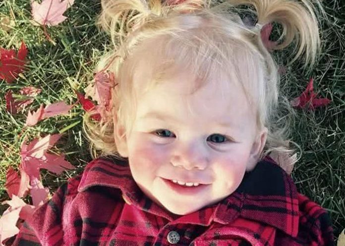 urticaria acuagenica