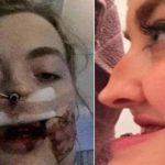 Le decían «Bulldog», se operó y ahora está irreconocible (Fotos) rebecca hamilton