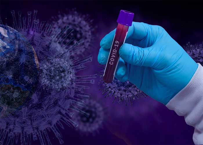 Prueba-COVID francia