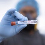 Las Américas registraron casi 5 millones de contagios de COVID la semana pasada americas