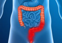 Conocé las terribles causas y síntomas de la colitis colitis