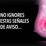 Estas son las señales del cáncer de mama a las que debes estar alerta cancer