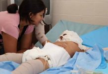 Perú: «Endemoniada» quema la cara a su hijo con cuchillo caliente nino quemado