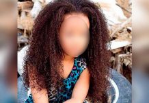 Colombia: Perforan pulmón a niña mientras le robaban el cabello nina