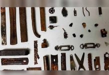 Intervienen a cubano y le extraen 32 objetos metálicos del estómago objetos metalicos