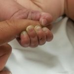 ¿Tienes uñas amarillas o débiles? Esto dicen sobre tu salud unas debiles