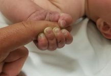 ¿Tienes uñas amarillas o débiles? Esto dicen sobre tu salud unas debiles