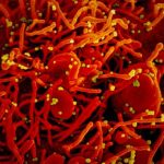 Rebrote: ¿Quién es el primer reinfectado por covid-19 en el mundo? salud