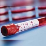 Aumenta a un 96% los casos de VIH Sida en Chile prueba del vih