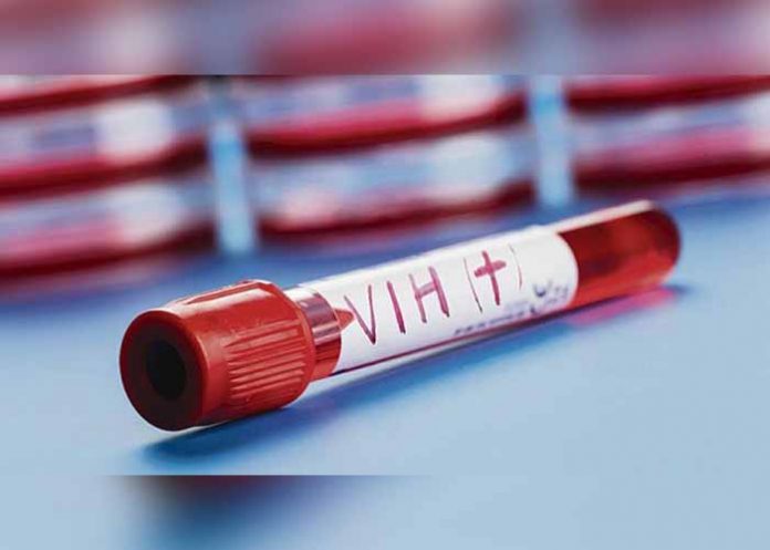 prueba del vih