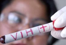 prueba del vih