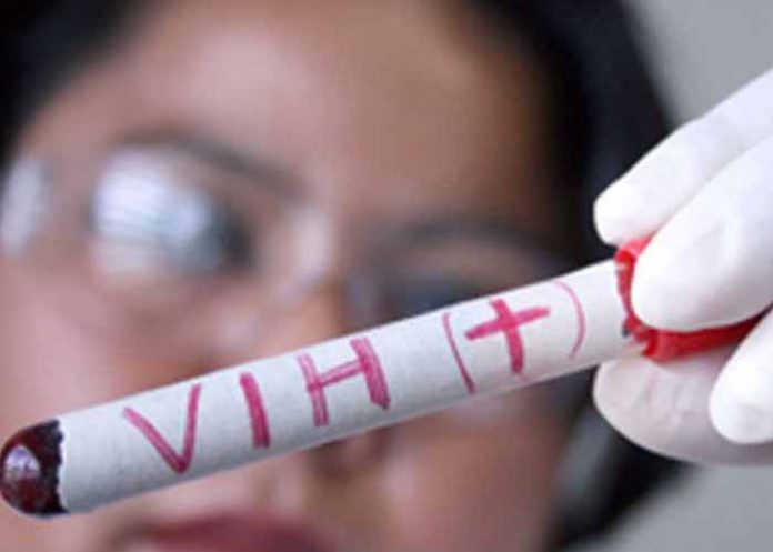 Untitled-1_LQAu2sP prueba del vih