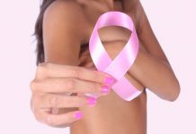 cancer de mama