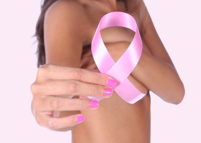 cancer de mama