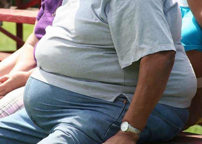 obesidad