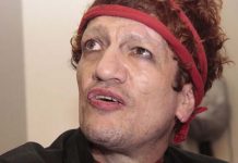 Rockero «Pity» Álvarez se entregó a la policía de Argentina rockero