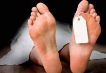 Hombre infectado por rabia fallece en hospital de Costa Rica cadaver tapado