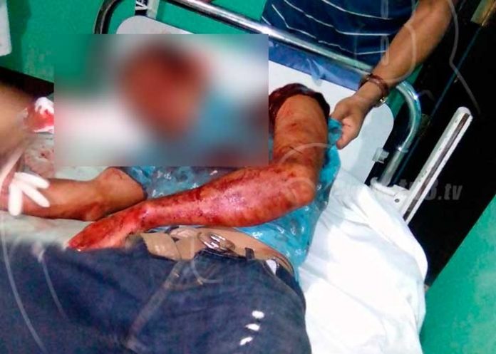 vandalos antisandinistas