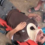 Dos jóvenes motociclistas lesionados al chocar contra una camioneta accidente en managua