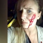 España: Una activista vegana libera 16 conejos y los granjeros disparan contra su auto activista