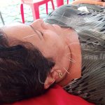 Pacientes del Hospital Alemán en Managua reciben atención en fisioterapia nicaragua