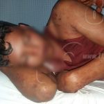 Agredido por no querer seguir pagando licor en bar de Jalapa nicaragua