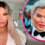 Jessica Alves y su relleno de mentón que le dejó un agujero en la cara brasil