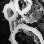 EEUU: alerta por Ameba «comecerebros» puede matar en cinco días estados unidos