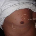 Pobladores de San Benito son agredidos por vándalos enemigos de la paz nicaragua