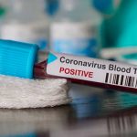 Argentina: Confirman el primer caso de coronavirus argentina