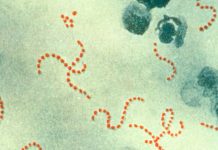 ¡OJO! Síntomas de la bacteria come carne pueden confundirse con los de gripe