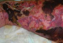 bacteria come carne