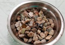 Doctores salvan a sujeto con síndrome de ansiedad que tomó pana llena de basura doctores