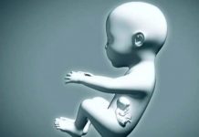 Bebé que nació embarazada de su hermano gemelo con salud estable