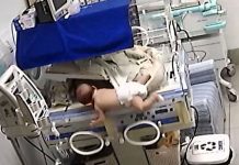 Brasil: Bebé se fractura el cráneo al caer de una incubadora (VIDEO) brasil