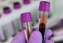 Rusia trabaja en la elaboración de una vacuna contra el coronavirus estudio