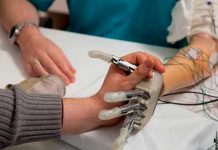 Crean método para restaurar sensación de movimiento en pacientes amputados sensacion de movimiento