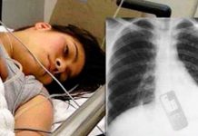 Mujer se traga el celular para evitar que su novio lea los mensajes brasil