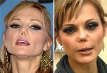¡Sin remedio! Ni Botched puede con la nariz de Carmen Campuzano estados unidos