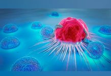 ¿Los introvertidos tienen mayor riesgo de desarrollar cáncer? los introvertidos