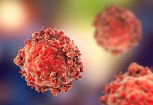 Desarrollan nueva prueba sanguínea que detecta 7 tipos de cáncer desarrollan nueva prueba