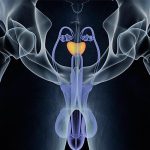 Nuevo tratamiento para cáncer de próstata podría ser menos dañino cancer de prostata