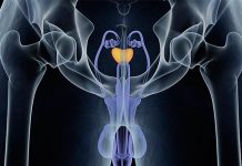Nuevo tratamiento para cáncer de próstata podría ser menos dañino cancer de prostata