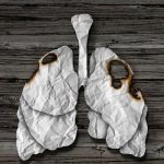 7 causas de cáncer de pulmón que no son fumar y no conocías cancer de pulmon